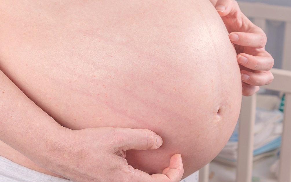 Ce este colestaza de sarcina?