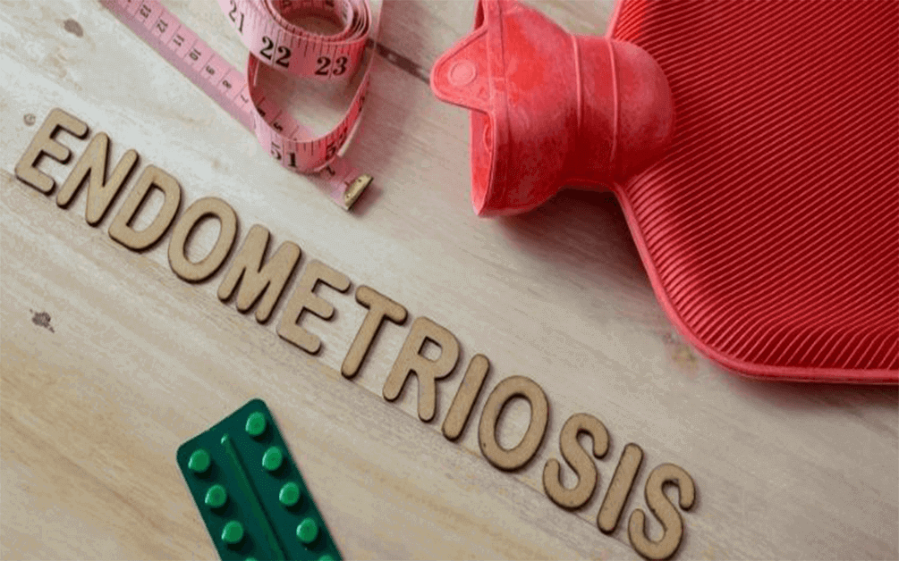 Endometrioza