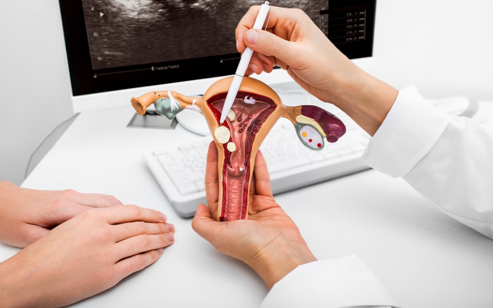 Diagnostic in cervicita